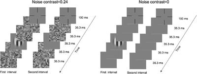 Lower Internal Additive Noise and Better Perceptual Template Characterize Binocular Contrast Sensitivity Summation